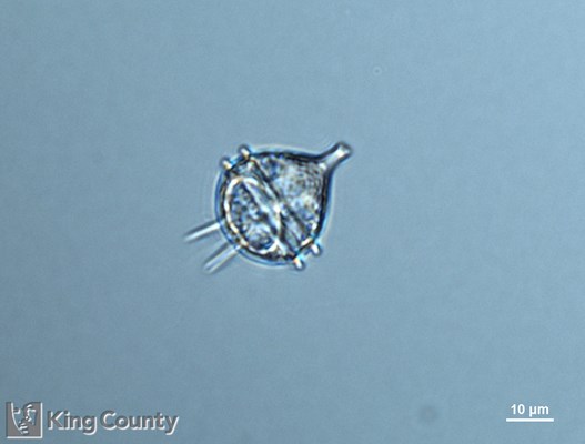 Photo of Protoperidinium pellucidum/Protoperidinium steinii